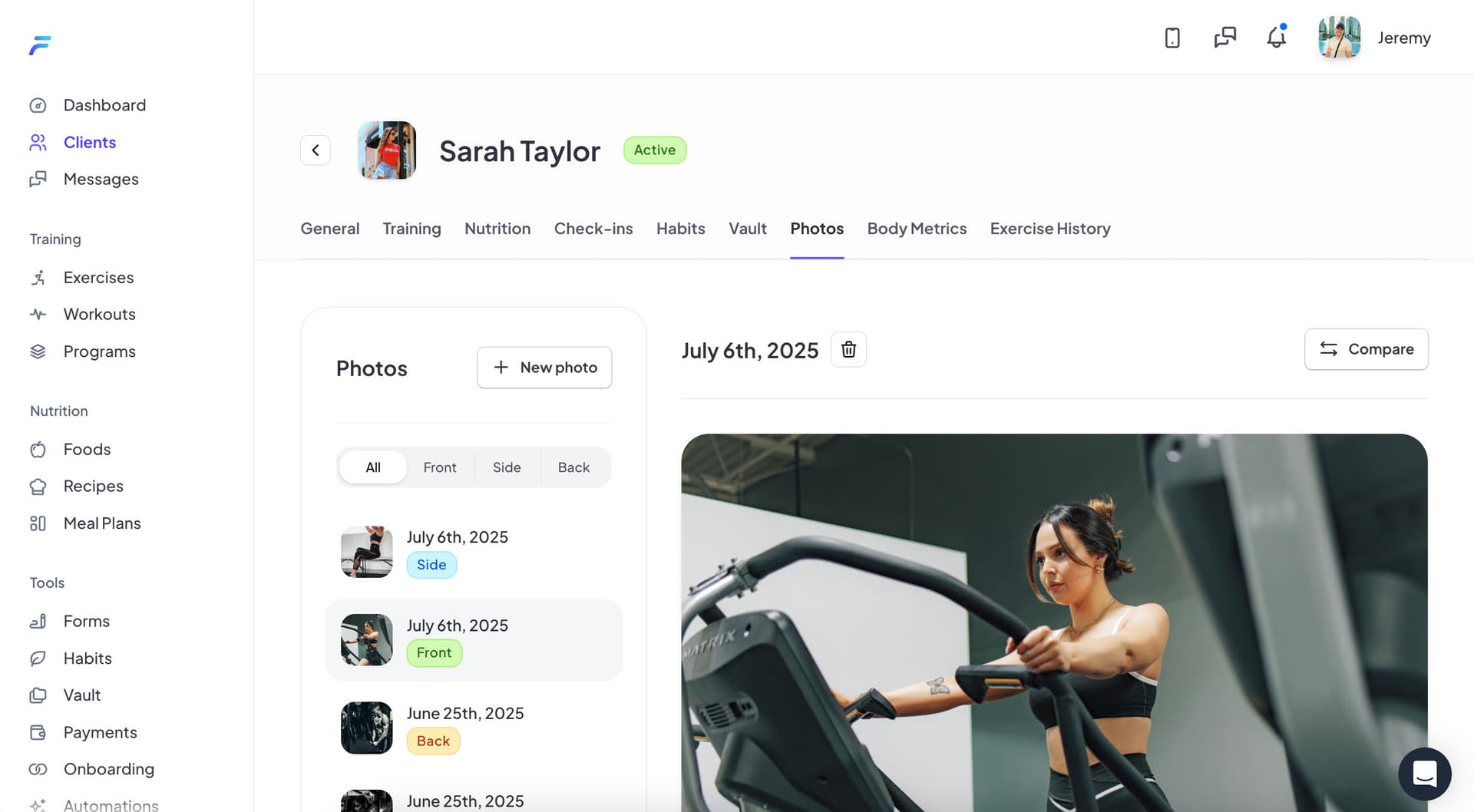 Progress photo management interface with comparison views
